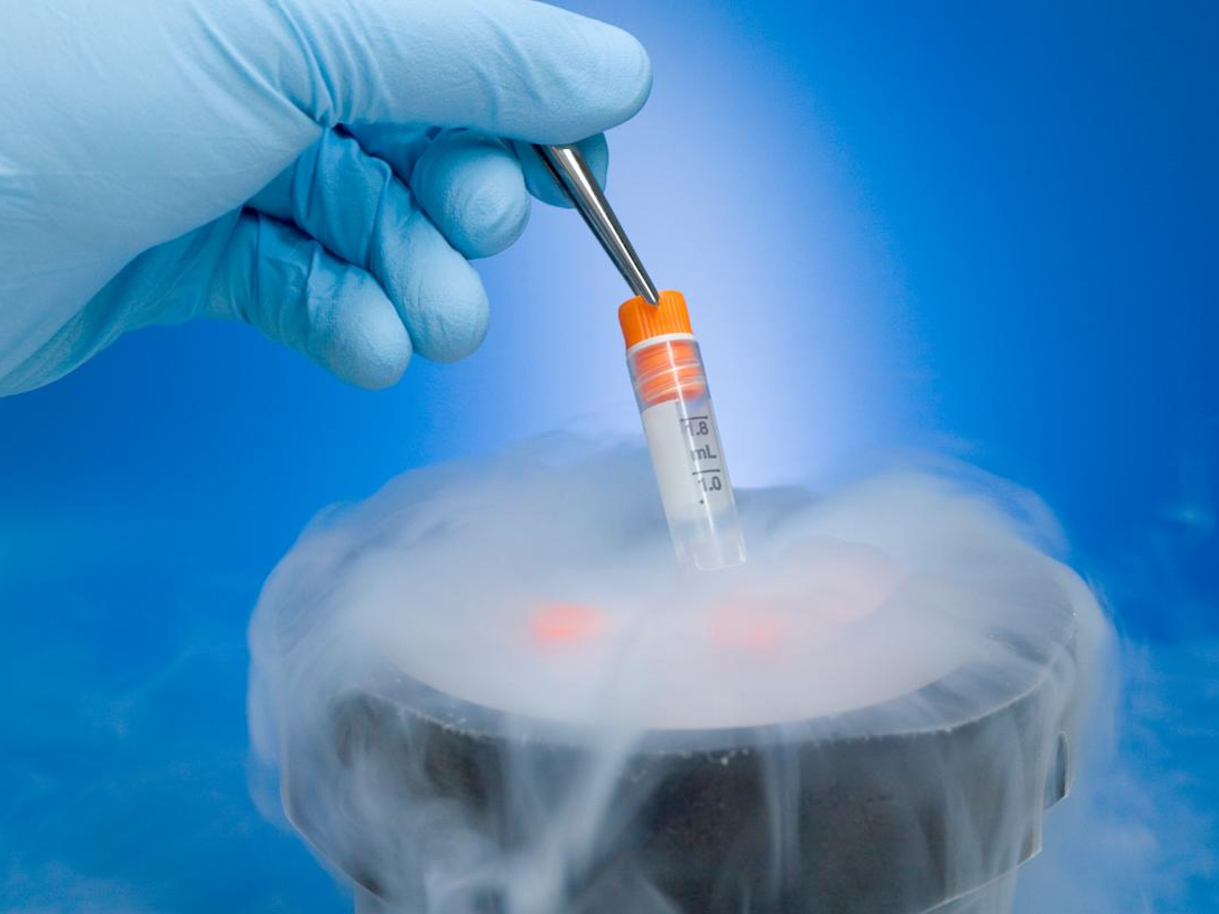 Embryo Freezing Procedure in Pakistan